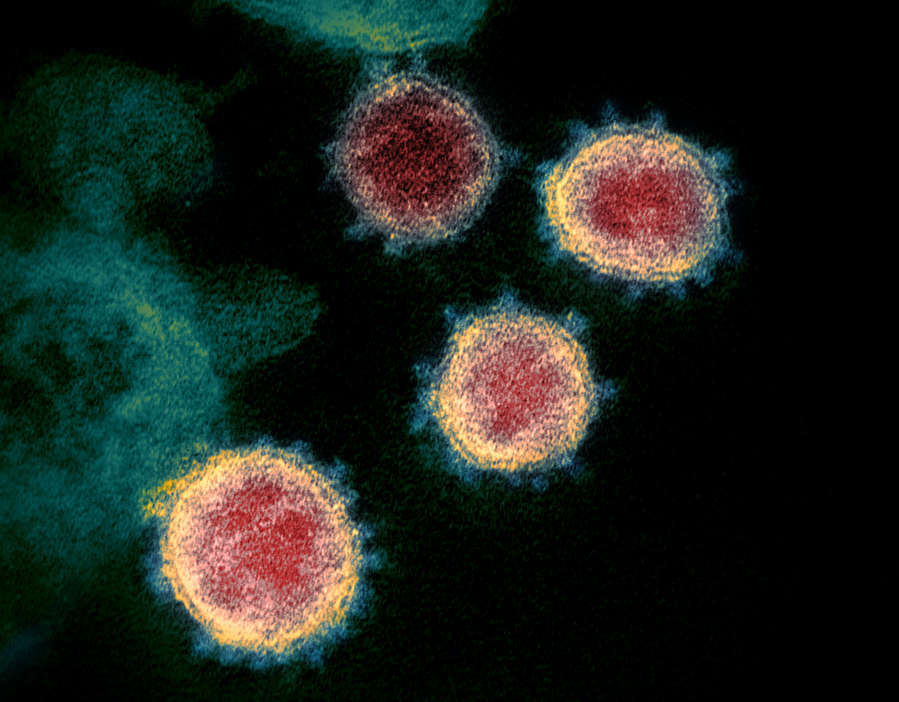 Imagen del Coronavirus SARS-CoV-2. Capturada y coloreada en los Laboratorios de las Montañas Rocosas del NIAID (RML) en Hamilton